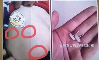 “小能人幼儿园老师针扎幼童”事件 背后“针相”到底是什么 ...